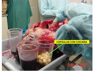 CÁPSULAS CON COCAÍNA 