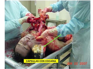 CÁPSULAS CON COCAÍNA 