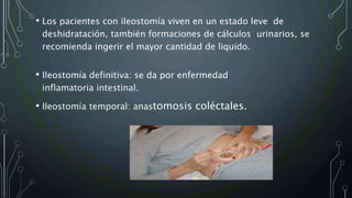 • Los pacientes con ileostomía viven en un estado leve de
deshidratación, también formaciones de cálculos urinarios, se
recomienda ingerir el mayor cantidad de liquido.
• Ileostomía definitiva: se da por enfermedad
inflamatoria intestinal.
• Ileostomía temporal: anastomosis coléctales.
 