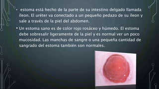 • estoma está hecho de la parte de su intestino delgado llamada
íleon. El uréter va conectado a un pequeño pedazo de su íleon y
sale a través de la piel del abdomen.
• Un estoma sano es de color rojo rosáceo y húmedo. El estoma
debe sobresalir ligeramente de la piel y es normal ver un poco
mucosidad. Las manchas de sangre o una pequeña cantidad de
sangrado del estoma también son normales.
 