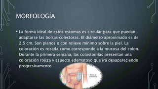 MORFOLOGÍA
• La forma ideal de estos estomas es circular para que puedan
adaptarse las bolsas colectoras. El diámetro aproximado es de
2.5 cm. Son planos o con relieve mínimo sobre la piel. La
coloración es rosada como corresponde a la mucosa del colon.
Durante la primera semana, las colostomías presentan una
coloración rojiza y aspecto edematoso que irá desapareciendo
progresivamente.
 