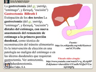 “Curso de Anatomía Humana:
      Carrera de Médico Cirujano”


La gastrectomía (del gr. γαστήρ,
"estómago", y ἐκτομή, "escisión")
Gastrectomía Billroth I
Extirpación de los dos tercios La
gastrectomía (del gr. γαστήρ,
"estómago", y ἐκτομή, "escisión")
distales del estómago, con nueva
anastomosis del remanente de
estómago a la primera porción
duodenal, como técnica de
                                                        Fuente:
reconstrucción del tránsito alimentario. http://es.wikipedia.org/wiki/Gastrect
Es la intervención de elección en una                om%C3%ADa
patología no maligna del estómago o en
las úlceras duodenales que requieran
                                            Vínculo video cirugía:
gastrectomía. Ver antrectomía, http://www.youtube.com/watch?v=q_6LeigHP
gastroduodenostomía.             Zs&feature=share&list=UUaaBeNLQa1VCnc
© Espasa Calpe, S.A.                                Gjl3IIQPg               48
 