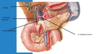 Cística
A. Gástrica
Derecha
A. Gastroduodenal
A. Hepática Comun
 