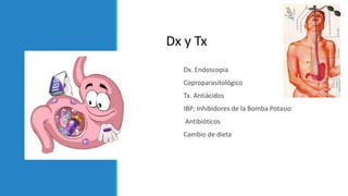 Dx. Endoscopia
Coproparasitológico
Tx. Antiácidos
IBP; Inhibidores de la Bomba Potasio
Antibióticos
Cambio de dieta
Dx y Tx
 