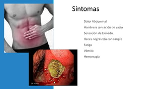 Dolor Abdominal
Hambre y sensación de vacío
Sensación de Llenado
Heces negras y/o con sangre
Fatiga
Vómito
Hemorragía
Síntomas
 