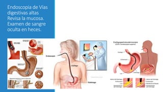 Endoscopia de Vías
digestivas altas
Revisa la mucosa.
Examen de sangre
oculta en heces.
 