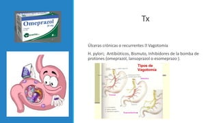 Tx
Úlceras crónicas o recurrentes Vagotomía
H. pylori; Antibióticos, Bismuto, Inhibidores de la bomba de
protones (omeprazol, lansoprazol o esomeprazo ).
 