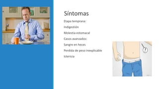 Síntomas
Etapa temprana:
Indigestión
Molestia estomacal
Casos avanzados:
Sangre en heces
Perdida de peso inexplicable
Ictericia
 