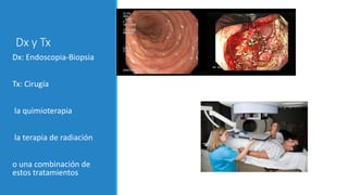 Dx y Tx
Dx: Endoscopia-Biopsia
Tx: Cirugía
la quimioterapia
la terapia de radiación
o una combinación de
estos tratamientos
 