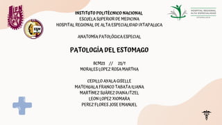 INSTITUTO POLITÉCNICO NACIONAL
ESCUELA SUPERIOR DE MEDICINA
HOSPITAL REGIONAL DE ALTA ESPECIALIDAD IXTAPALUCA
ANATOMÍA PATOLÓGICA ESPECIAL
PATOLOGÍA DEL ESTOMAGO
8CM23 // 23/1
MORALES LOPEZ ROSA MARTHA
CEDILLO AYALA GISELLE
MATEHUALA FRANCO TABATA ILIANA
MARTÍNEZ SUÁREZ DIANA ITZEL
LEON LOPEZ XIOMARA
PEREZ FLORES JOSE EMANUEL
 
