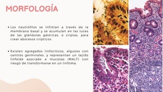 Exposición Anatomía patológica de ESTOMAGO | PDF