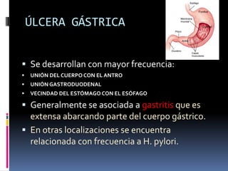 ÚLCERA GÁSTRICA
 Se desarrollan con mayor frecuencia:
 UNIÓN DEL CUERPO CON EL ANTRO
 UNIÓN GASTRODUODENAL
 VECINDAD DEL ESTÓMAGO CON EL ESÓFAGO
 Generalmente se asociada a gastritis que es
extensa abarcando parte del cuerpo gástrico.
 En otras localizaciones se encuentra
relacionada con frecuencia a H. pylori.
 