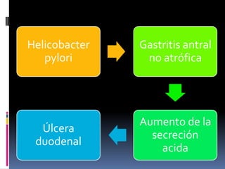 Helicobacter
pylori
Gastritis antral
no atrófica
Aumento de la
secreción
acida
Úlcera
duodenal
 