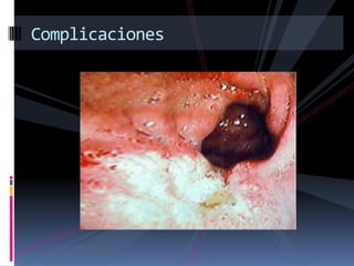 Complicaciones
 