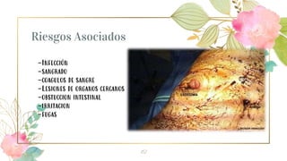 Riesgos Asociados
12
-Infección
-sangrado
-coagulos de sangre
-Lesiones de organos cercanos
-obstuccion intestinal
-irritacion
-fugas
 