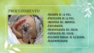 PROCEDIMIENTO
19
.
•Incisión de la piel.
•Protección de la piel.
•Abertura del abdomen.
•Exploración.
•Identificación del colon.
•Exposición del colon.
•Oclusión parcial de la herida.
•Descomprension.
 