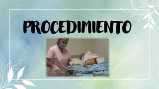 26
PROCEDIMIENTO
 