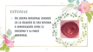 ESTOMAS
⊳ Un estoma intestinal consiste
en la creación de una ventana
o comunicación entre el
intestino y la pared
abdominal,
5
 