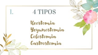 1. 4 TIPOS
Ileostomia
Yeyunostomia
Colostomia
Gastrostomia
 