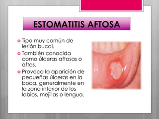 ESTOMATITIS AFTOSA
 Tipo muy común de
lesión bucal.
 También conocida
como úlceras aftosas o
aftas.
 Provoca la aparición de
pequeñas úlceras en la
boca, generalmente en
la zona interior de los
labios, mejillas o lengua.
 