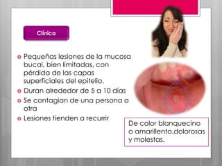  Pequeñas lesiones de la mucosa
bucal, bien limitadas, con
pérdida de las capas
superficiales del epitelio.
 Duran alrededor de 5 a 10 días
 Se contagian de una persona a
otra
 Lesiones tienden a recurrir
Clínica
De color blanquecino
o amarillento,dolorosas
y molestas.
 