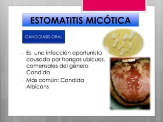 ESTOMATITIS MICÓTICA
- Es una infección oportunista
causada por hongos ubicuos,
comensales del género
Candida
- Más común: Candida
Albicans
CANDIDIASIS ORAL
 
