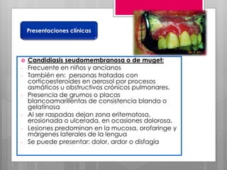 Candidiasis seudomembranosa o de muget:
- Frecuente en niños y ancianos
- También en: personas tratadas con
corticoesteroides en aerosol por procesos
asmáticos u obstructivos crónicos pulmonares.
- Presencia de grumos o placas
blancoamarillentas de consistencia blanda o
gelatinosa
- Al ser raspadas dejan zona eritematosa,
erosionada o ulcerada, en ocasiones dolorosa.
- Lesiones predominan en la mucosa, orofaringe y
márgenes laterales de la lengua
- Se puede presentar: dolor, ardor o disfagia
Presentaciones clínicas
 