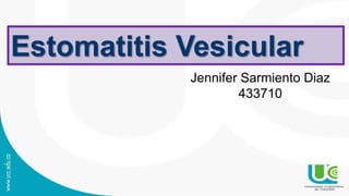 Estomatitis Vesicular
Jennifer Sarmiento Diaz
433710
 