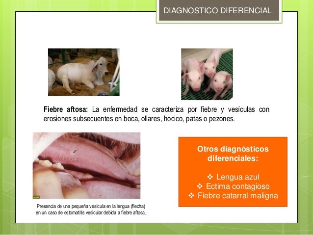 Estomatitis vesicular