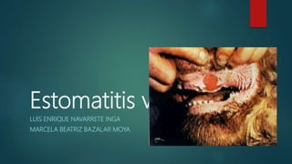 Estomatitis vesicular
LUIS ENRIQUE NAVARRETE INGA
MARCELA BEATRIZ BAZALAR MOYA
 