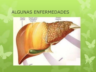 ALGUNAS ENFERMEDADES
 