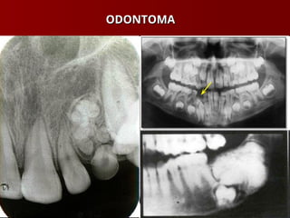 ODONTOMA
ODONTOMA
 