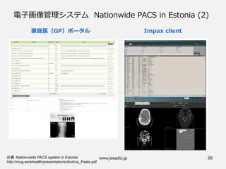 電子画像管理システム Nationwide PACS in Estonia (2)
出典：Nation-wide PACS system in Estonia
http://mug.ee/ehealth/presentations/Andrus_Paats.pdf
www.jeeadis.jp 99
家庭医（GP）ポータル Impax client
 