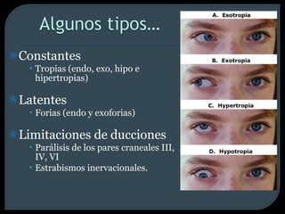Constantes Tropias (endo, exo, hipo e hipertropias) Latentes Forias (endo y exoforias) Limitaciones de ducciones Parálisis de los pares craneales III, IV, VI Estrabismos inervacionales. 