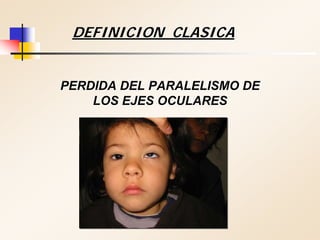 PERDIDA DEL PARALELISMO DEPERDIDA DEL PARALELISMO DE
LOS EJES OCULARESLOS EJES OCULARES
DEFINICION CLASICADEFINICION CLASICA
 