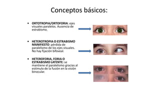 ESTRABISMO.pptx