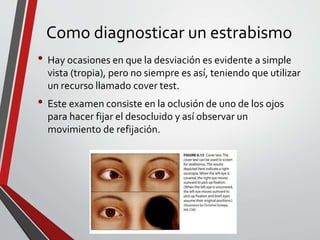 Como diagnosticar un estrabismo
• Hay ocasiones en que la desviación es evidente a simple
vista (tropia), pero no siempre es así, teniendo que utilizar
un recurso llamado cover test.
• Este examen consiste en la oclusión de uno de los ojos
para hacer fijar el desocluido y así observar un
movimiento de refijación.
 