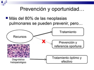Prevención y oportunidad…
 Más del 80% de las neoplasias
pulmonares se pueden prevenir, pero…
Recursos
Tratamiento
Prevención y
referencia oportuna
Tratamiento óptimo y
efectivo
X
 