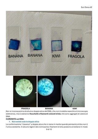 Sun Elena 4E
9 di 12
FRAGOLA BANANA KIWI
Non si riconoscerà la struttura a doppia elica del DNA, che non è visibile neanche al microscopio
elettronico, ma si vedranno fiocchetti e filamenti colorati di blu che sono aggregati di catena di
DNA.
CURIOSITÀ sul DNA:
1. Non esiste solo la doppia elica
La conformazione “classica” a doppia elica che ci viene in mente quando pensiamo al dna non è
l’unica esistente. In alcune regioni del cromosoma i filamenti di dna possono arrotolarsi in modo
 