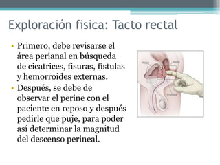Exploración fisica: Tacto rectal
• Primero, debe revisarse el
área perianal en búsqueda
de cicatrices, fisuras, fístulas
y hemorroides externas.
• Después, se debe de
observar el perine con el
paciente en reposo y después
pedirle que puje, para poder
así determinar la magnitud
del descenso perineal.
 