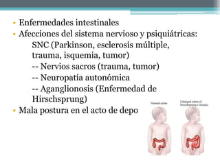 • Enfermedades intestinales
• Afecciones del sistema nervioso y psiquiátricas:
SNC (Parkinson, esclerosis múltiple,
trauma, isquemia, tumor)
-- Nervios sacros (trauma, tumor)
-- Neuropatía autonómica
-- Aganglionosis (Enfermedad de
Hirschsprung)
• Mala postura en el acto de deponer
 