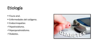 Etiología
 Fisura anal.
 Enfermedades del colágeno.
 Endocrinopatías:
Hipotiroidismo.
Hiperparatiroidismo.
Diabetes.
 