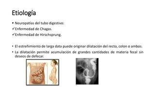 Etiología
 Neuropatías del tubo digestivo:
Enfermedad de Chagas.
Enfermedad de Hirschsprung.
• El estreñimiento de larga data puede originar dilatación del recto, colon o ambos.
• La dilatación permite acumulación de grandes cantidades de materia fecal sin
deseos de defecar.
 