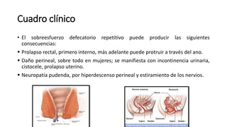 Cuadro clínico
• El sobreesfuerzo defecatorio repetitivo puede producir las siguientes
consecuencias:
 Prolapso rectal, primero interno, más adelante puede protruir a través del ano.
 Daño perineal, sobre todo en mujeres; se manifiesta con incontinencia urinaria,
cistocele, prolapso uterino.
 Neuropatía pudenda, por hiperdescenso perineal y estiramiento de los nervios.
 