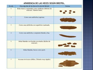 APARIENCIA DE LAS HECES SEGÚN BRISTOL.
 