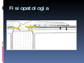 Estrella Macular | PPT
