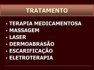  TERAPIA MEDICAMENTOSA
 MASSAGEM
 LASER
 DERMOABRASÃO
 ESCARIFICAÇÃO
 ELETROTERAPIA
TRATAMENTO
 
