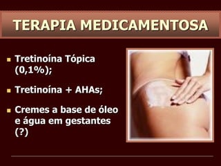  Tretinoína Tópica
(0,1%);
 Tretinoína + AHAs;
 Cremes a base de óleo
e água em gestantes
(?)
TERAPIA MEDICAMENTOSA
 