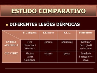  DIFERENTES LESÕES DÉRMICAS
F. Colágena F.Elástica S.F.A. Fibroblasto
ESTRIA
ATRÓFICA
Fina
Diâmetro <
Volume <
esparsa abundante Globular
Secreção 0
quiescente
CICATRIZ Grossa
Larga
Compacta
esparsa pouca Estrelado
Secreção ++
ativo
ESTUDO COMPARATIVO
 