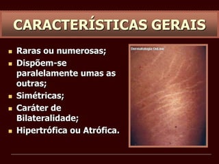  Raras ou numerosas;
 Dispõem-se
paralelamente umas as
outras;
 Simétricas;
 Caráter de
Bilateralidade;
 Hipertrófica ou Atrófica.
CARACTERÍSTICAS GERAIS
 